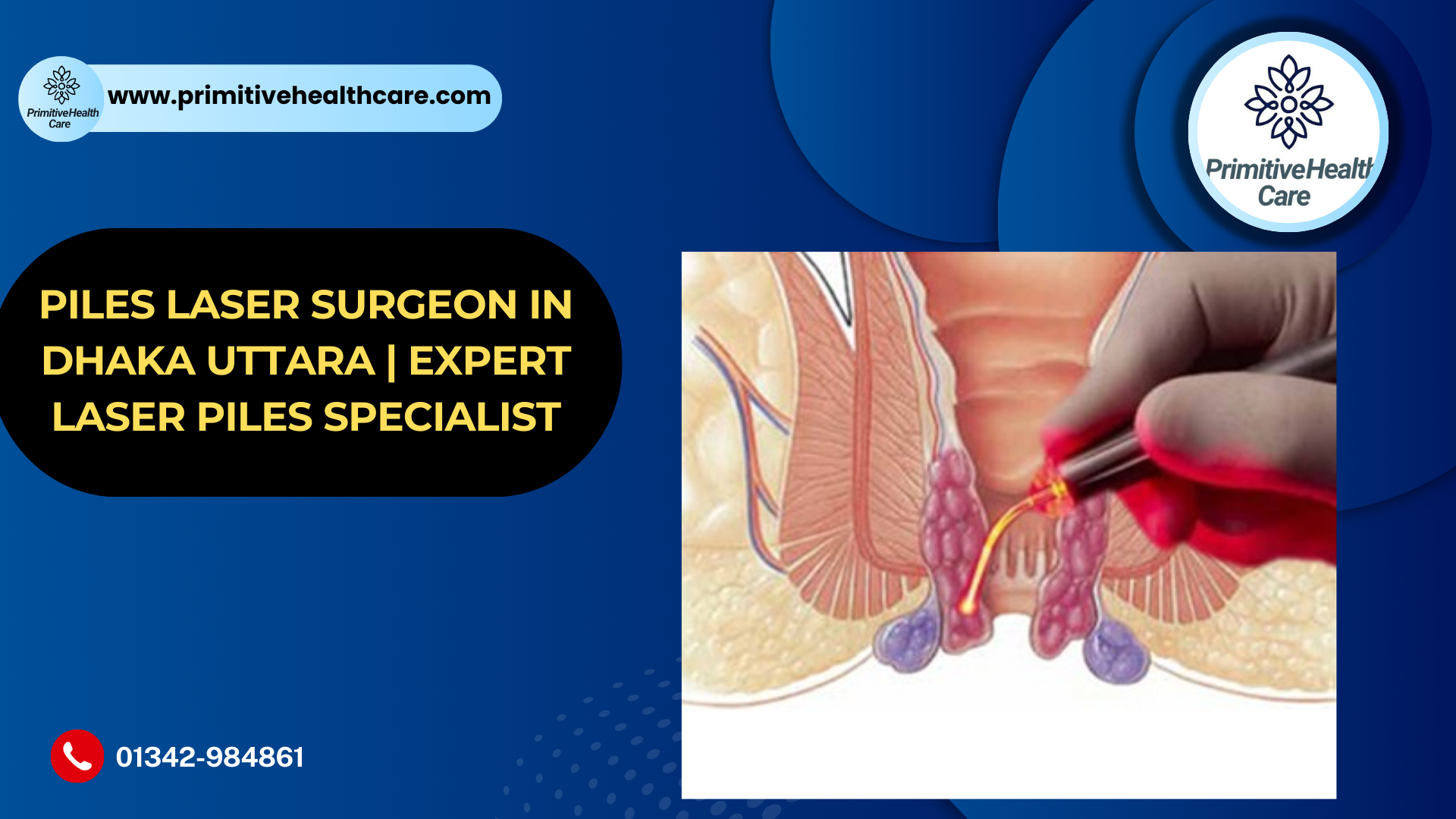 Best Piles Laser Surgeon in Dhaka Uttara – Advanced & Painless Treatment